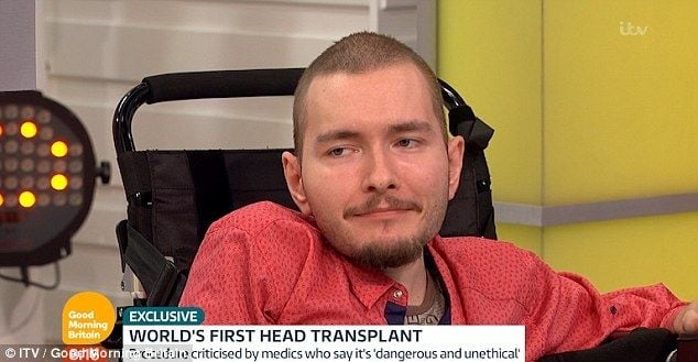Valery Spiridonov participará do primeiro transplante de cabeça