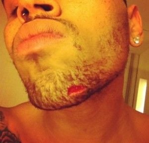 Chris Brown se envolve em briga e tem queixo cortado