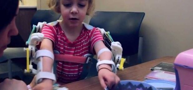 Impressora 3D cria braços para garota de 2 anos
