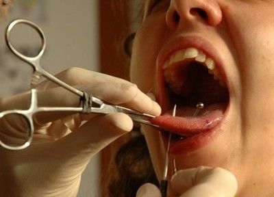 Cuidados especiais com os piercings na boca