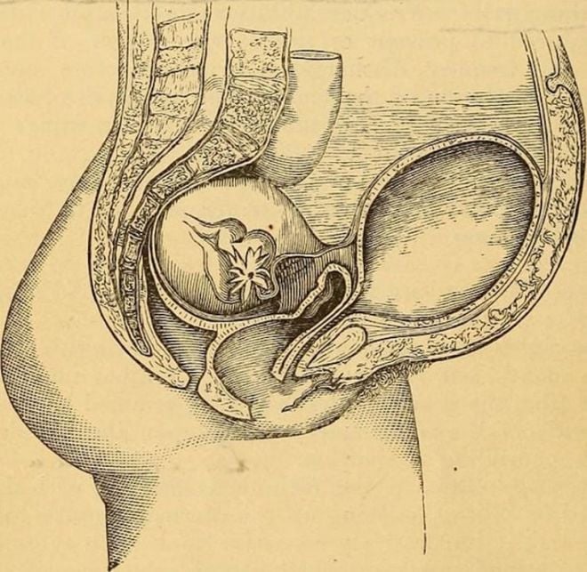 O útero passeava pelo corpo lendas antigas