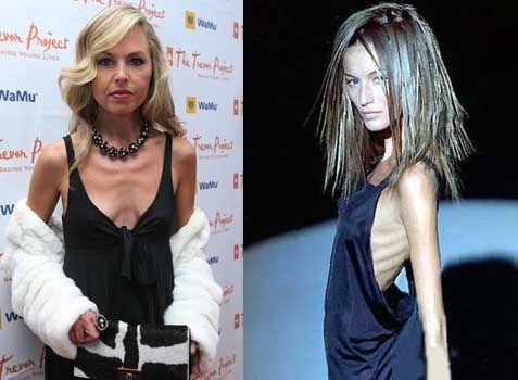 Mulheres extremamente magras