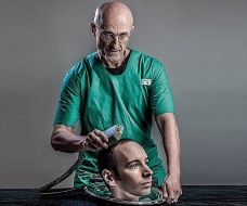 Primeiro transplante de cabeça do mundo acontecerá este ano