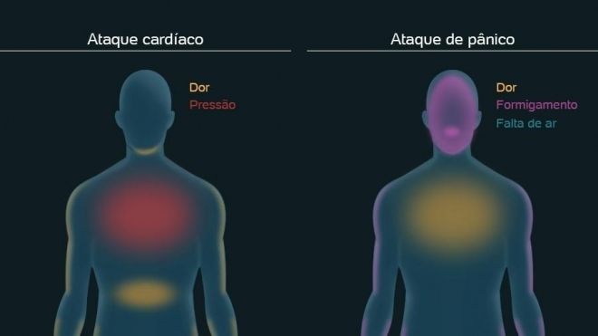 Como diferenciar ataque cardíaco e ataque de pânico?