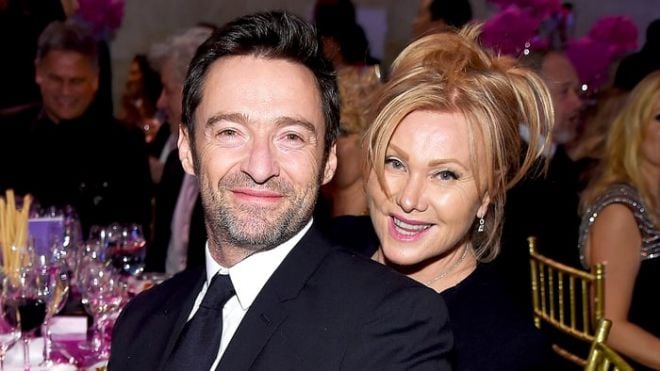 Famosos com namoradas com beleza questionada por alguns fãs Hugh e Deborra