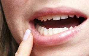 Confira algumas curiosidades sobre o dente siso