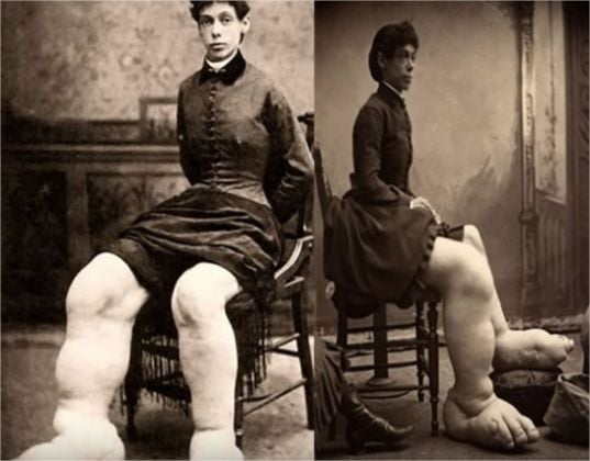 Confira algumas atrações bizarras que já foram sucesso nos freak shows