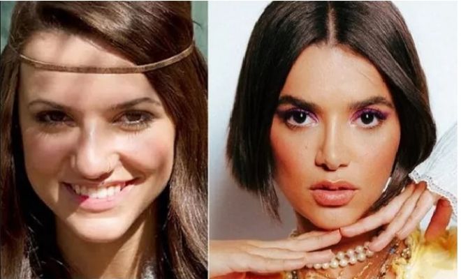 9 celebridades que fizeram rinoplastia