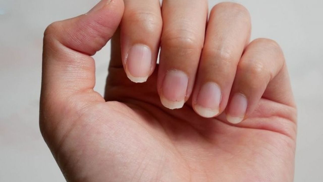 Unhas quebradiças? Confira dicas para deixar elas mais fortes