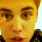 Justin Bieber posta vídeo após acidente