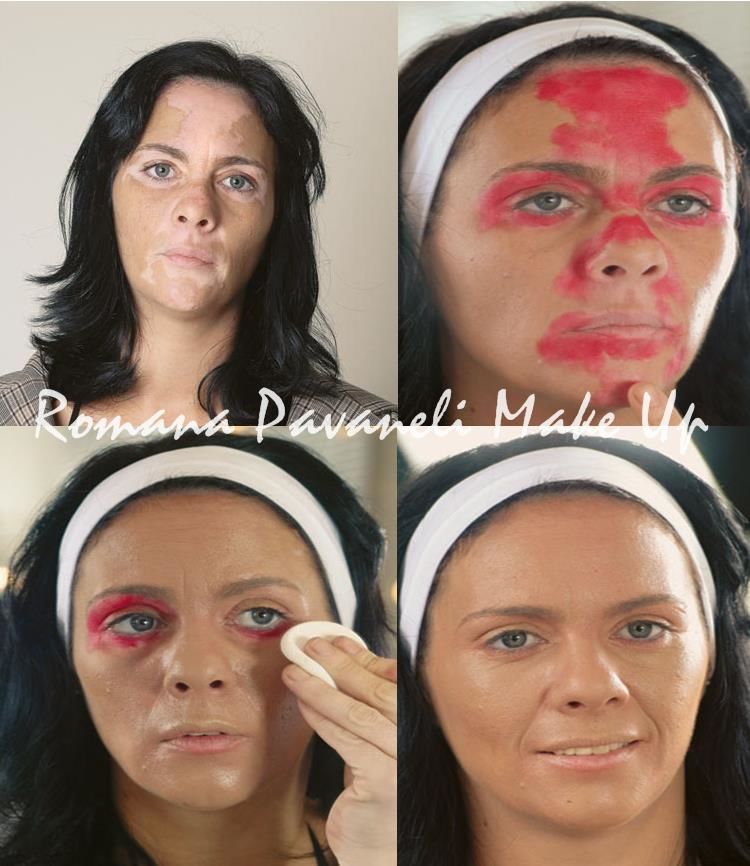 maquiagem-vitiligo