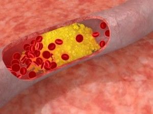 Níveis-de-colesterol-podem-variar-de-acordo-com-estacao-do-ano