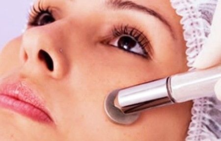 O Avanço da tecnologia a laser para tratamento de acnes