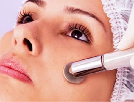 tratamento-a-laser-para-acne
