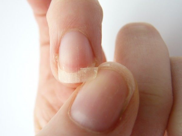 como-fortalecer-unhas-quebradicas