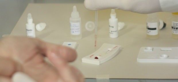 Teste de HIV/DST devem ser refeitos no período de um ano após a relação suspeita