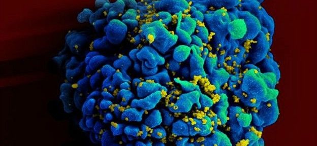 Tratamento em pacientes com vírus HIV usa terapia genética e melhora sistema imunológico