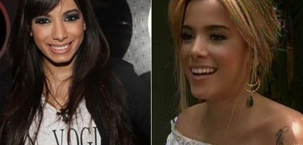 Mc Anitta antes e depois: polêmica com plásticas aos 21 anos na busca pela beleza 'ideal'