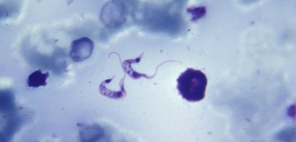 Doença de Chagas: pesquisadores criam novo tratamento para o Trypanossoma cruzi