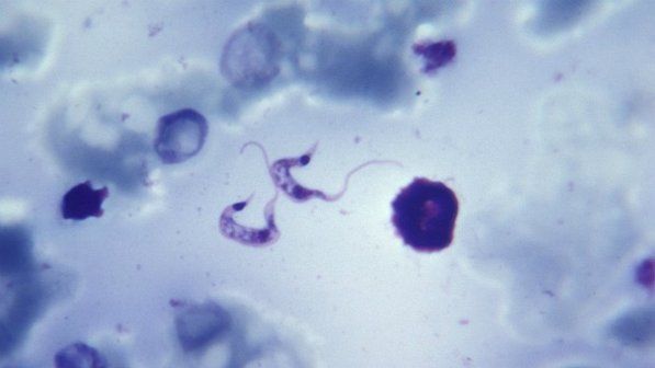 Doença de Chagas: pesquisadores criam novo tratamento para o Trypanossoma cruzi
