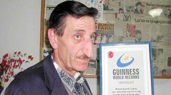 guiness-maior-nariz-do-mundo