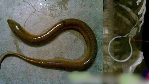 enguia-intestino
