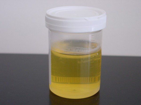 Anti séptico de urina