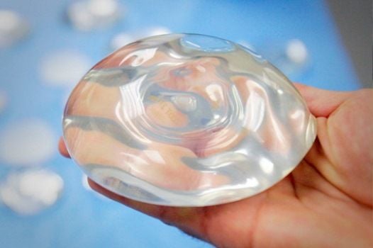 Casos inusitados envolvendo implantes de silicone