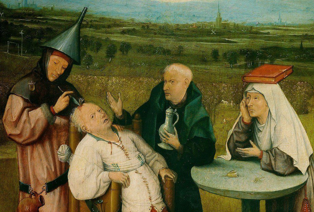 trepanacao